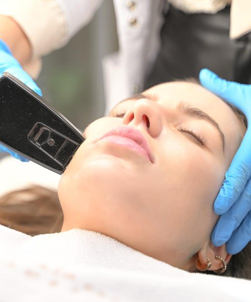 Plasma Pen fibroblast skin tightening treatment