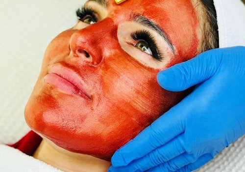 Microneedling facial treatment