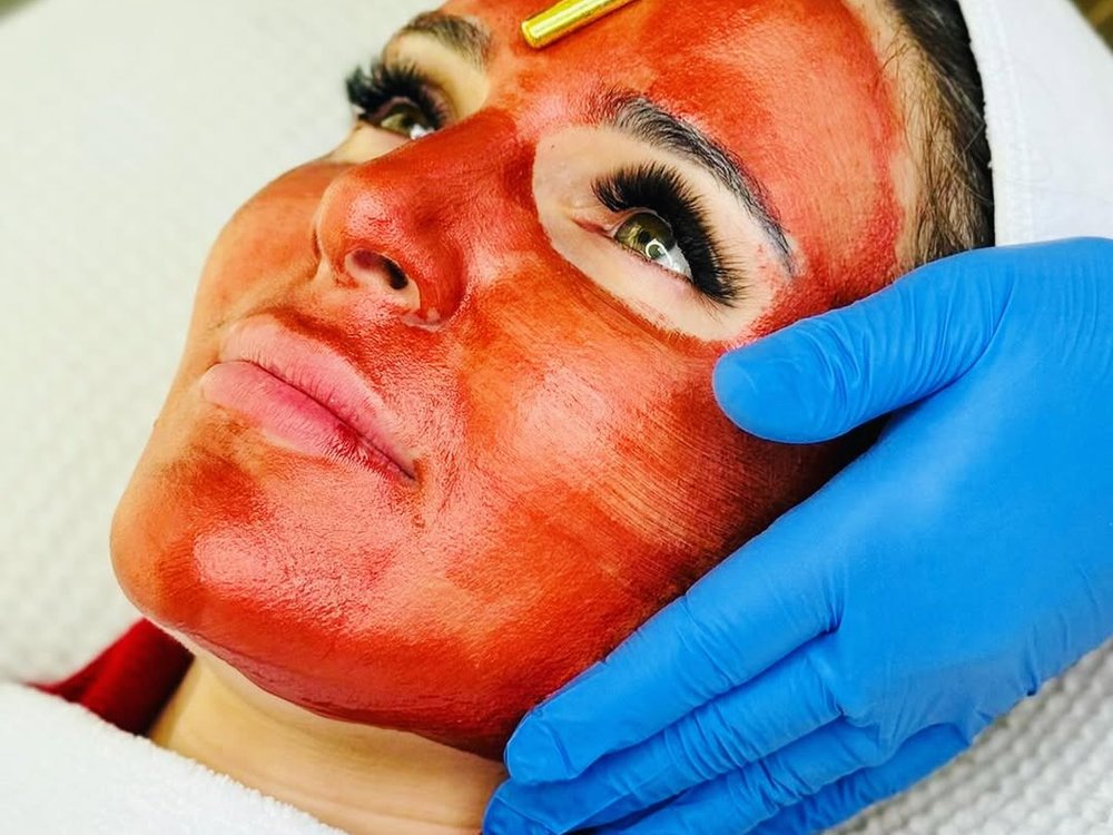 PRP platelet-rich plasma facial rejuvenation treatment at Ella Beauty Skin Care in Newark, NJ